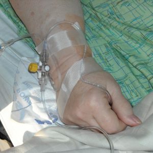 Patient wrist with PCA to IV catheter